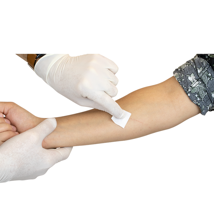 Dynarex Sterile Alcohol Prep Pads