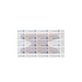 Dynarex Heavy Duty Woven Fabric Bandages