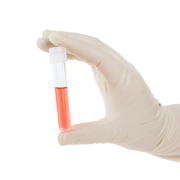 Dynarex LabChoice Culture Tube with Dual Position Caps