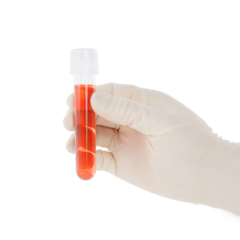 Dynarex LabChoice Culture Tube with Dual Position Caps