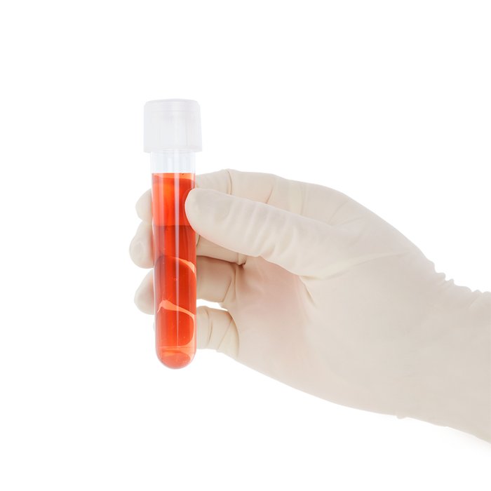 Dynarex LabChoice Culture Tube with Dual Position Caps