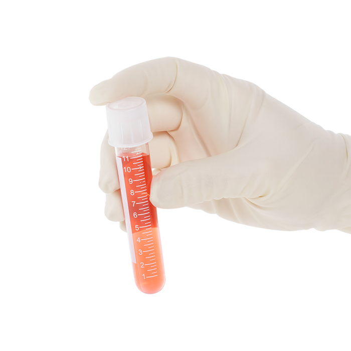 Dynarex LabChoice Culture Tube with Dual Position Caps