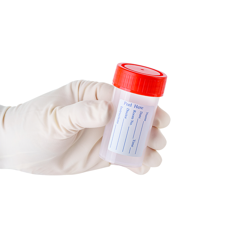Dynarex LabChoice Sputum Container