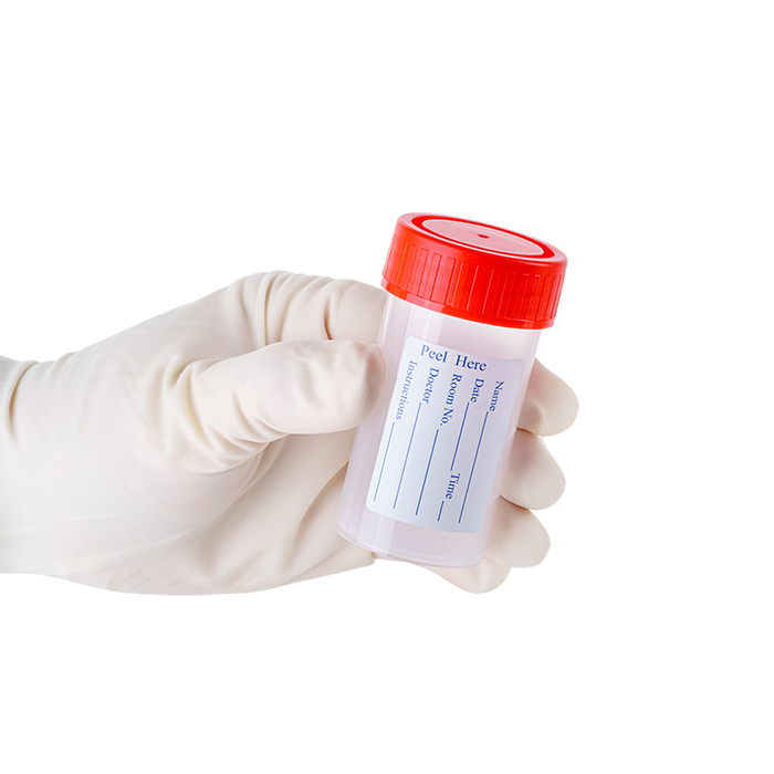 Dynarex LabChoice Sputum Container