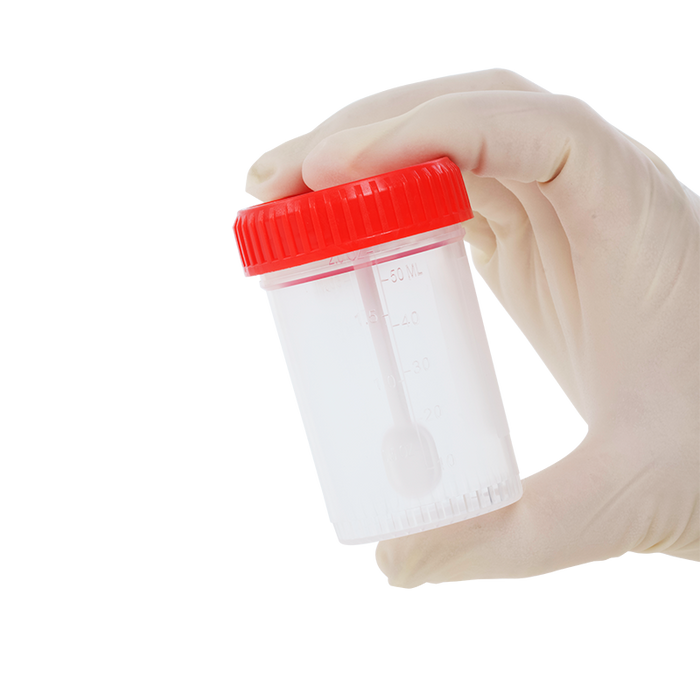 Dynarex LabChoice Stool Specimen Containers