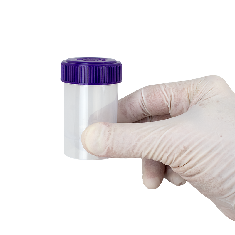 Dynarex LabChoice Specimen Containers