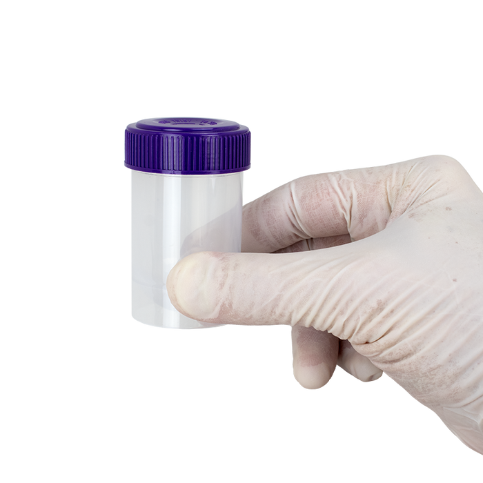 Dynarex LabChoice Specimen Containers