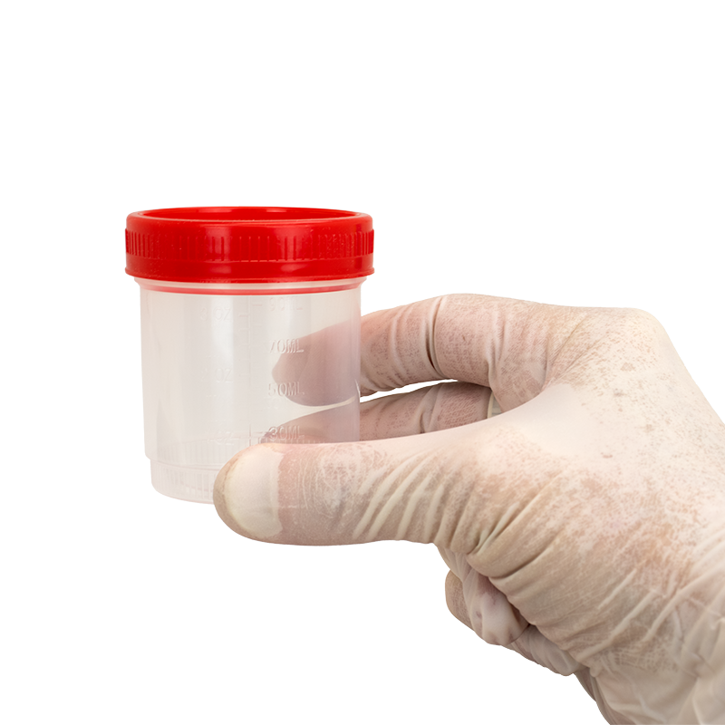 Dynarex LabChoice Specimen Containers