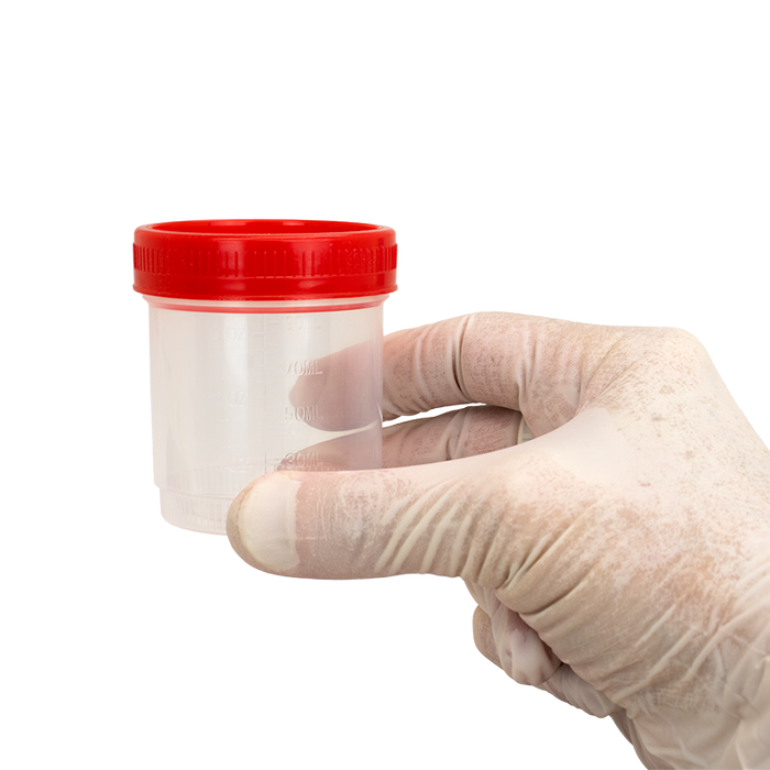 Dynarex LabChoice Specimen Containers