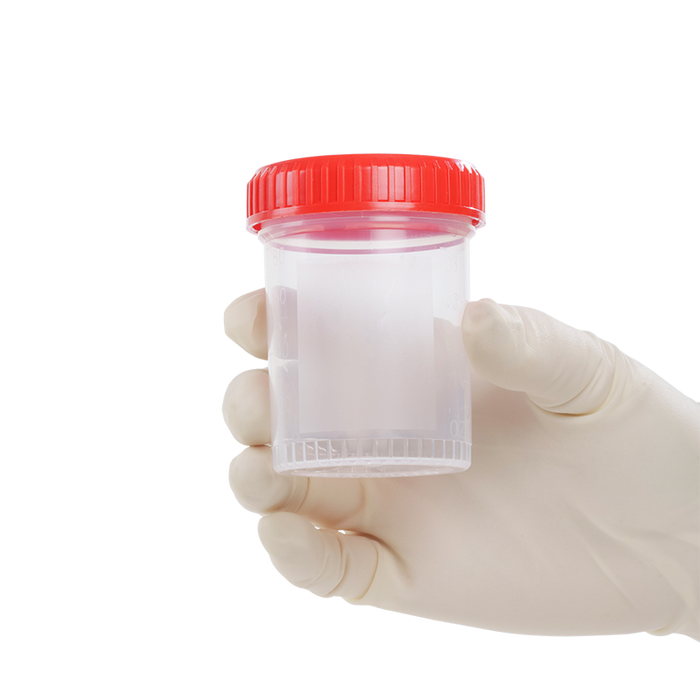 Dynarex LabChoice Specimen Containers